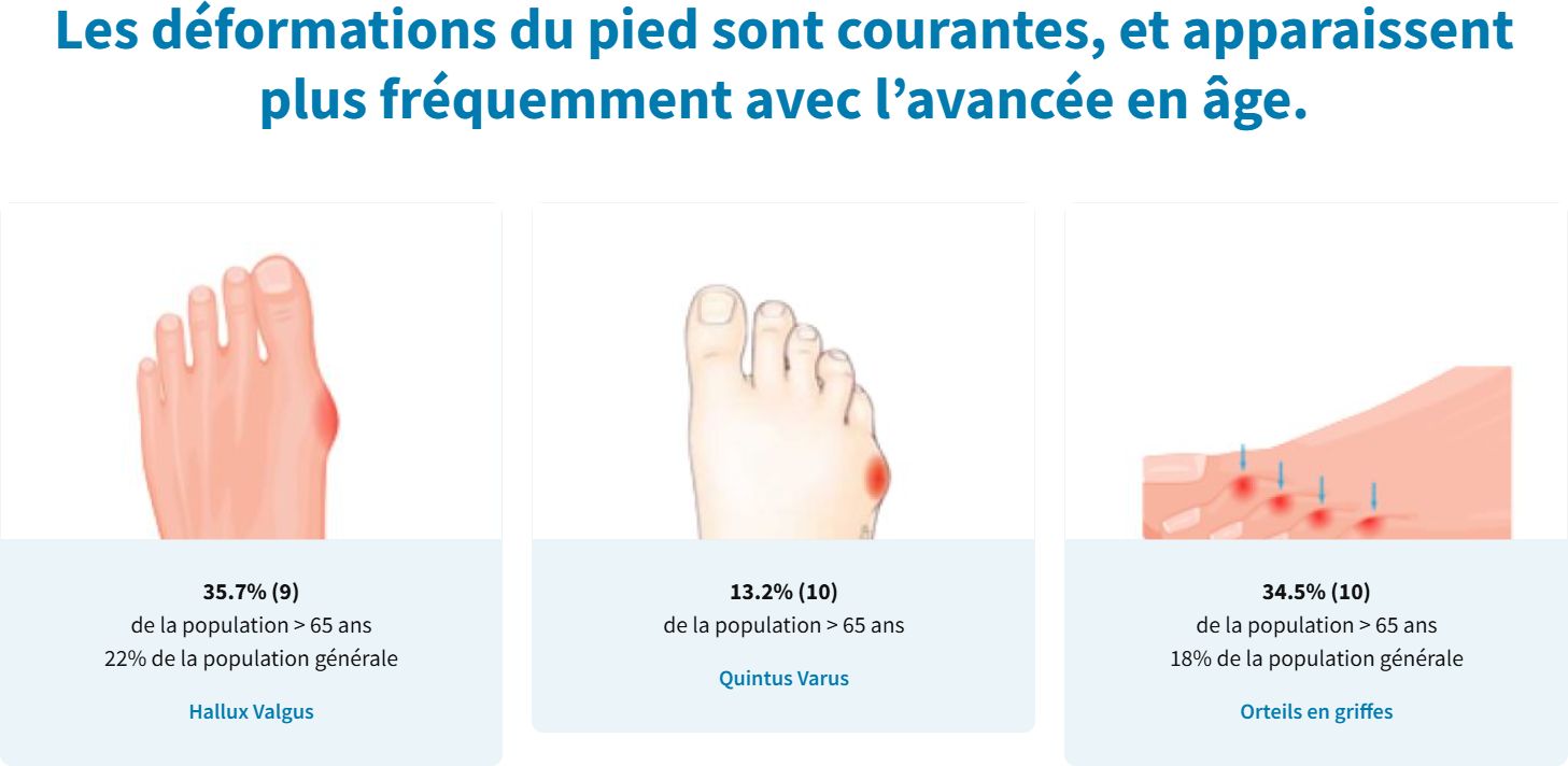 les déformations du pied.jpg